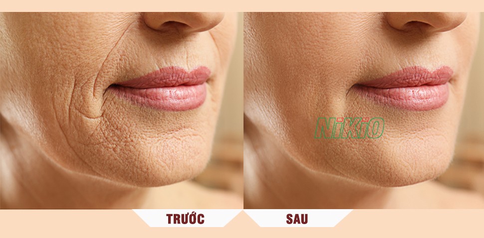 máy làm mặt nạ trái cây
