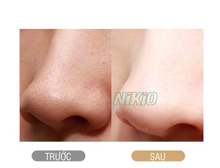 Máy nâng cơ tẩy tế bào chết Nikio NK-122