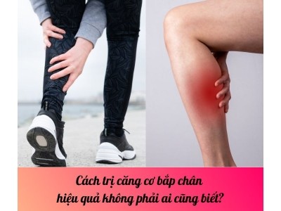 Cách trị căng cơ bắp chân hiệu quả không phải ai cũng biết?
