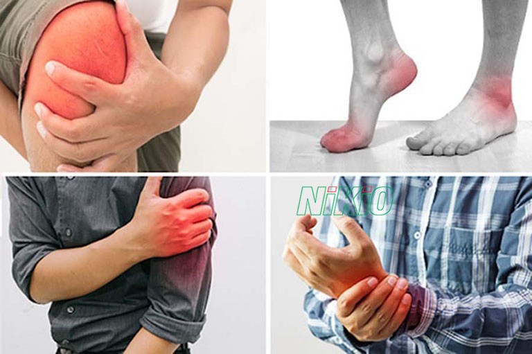 Đau nhức cơ toàn thân có cảm giác mệt mỏi và cử động rất khó khăn 